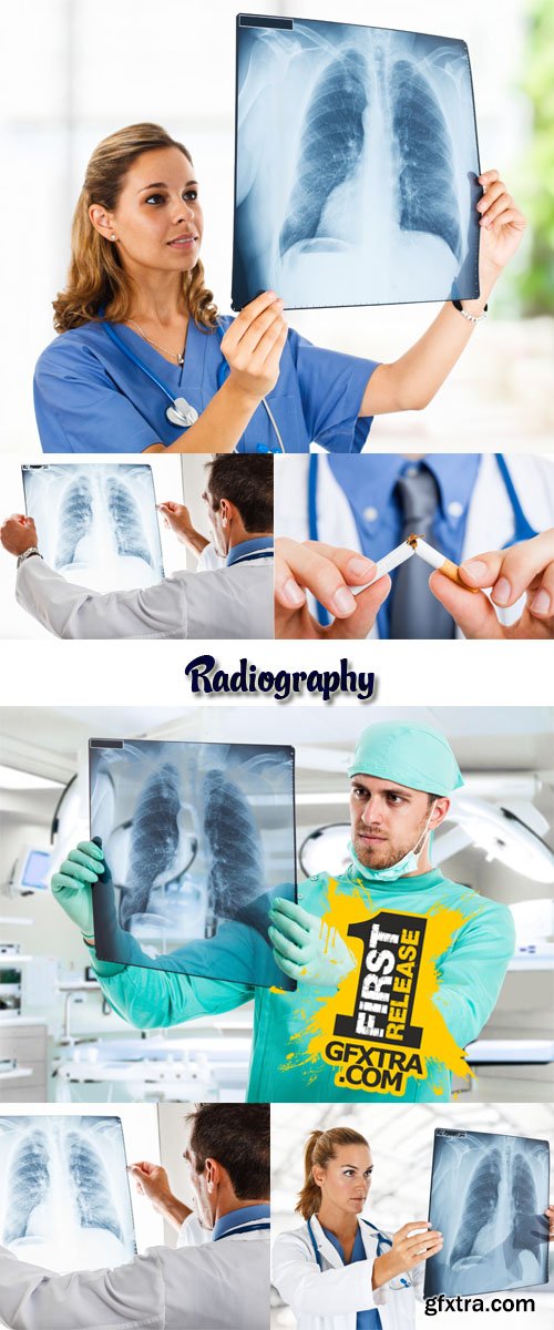 Stock Photos Radiography