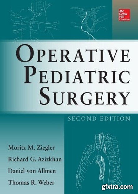 Operative Pediatric Surgery, 2nd Edition