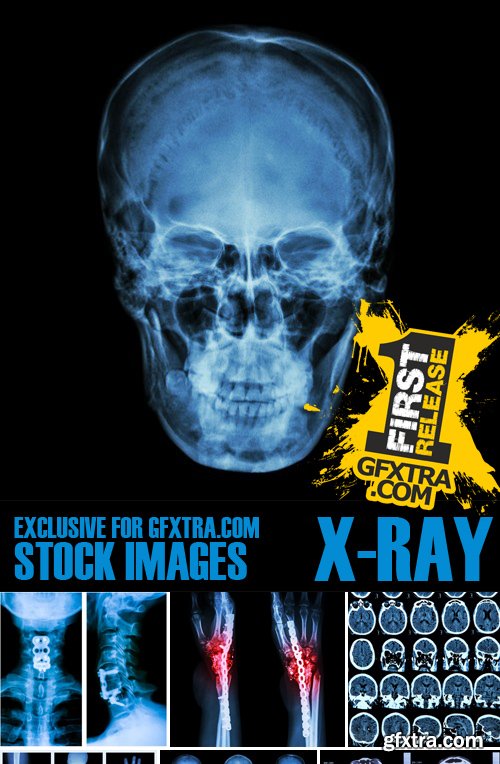 Stock Photos - X-ray, Roentgenogram, 25xJPG
