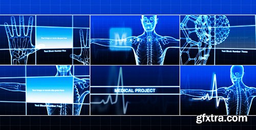Videohive Medical Project 236064
