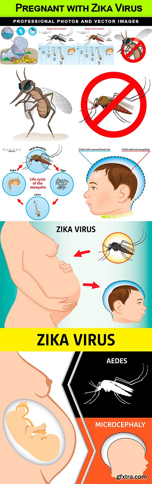 Pregnant with Zika Virus