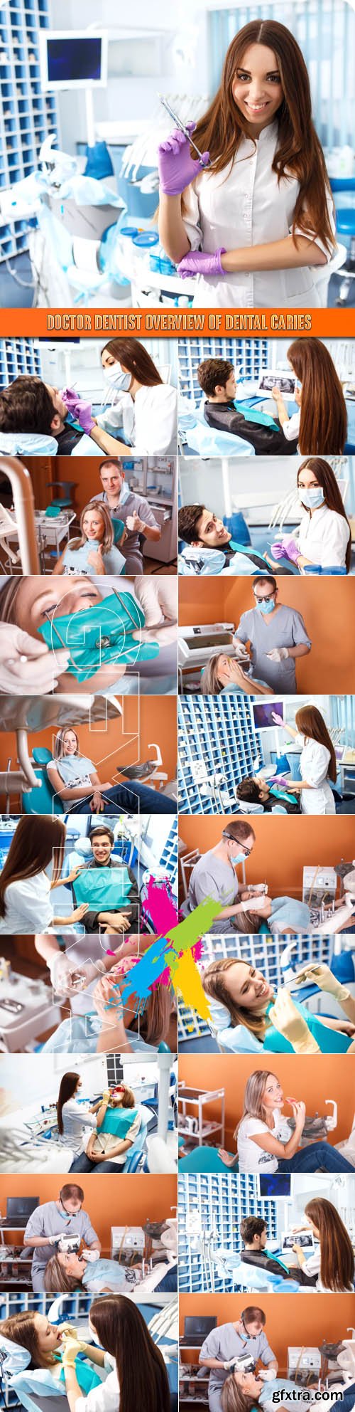 Doctor dentist Overview of dental caries - Stock Photos