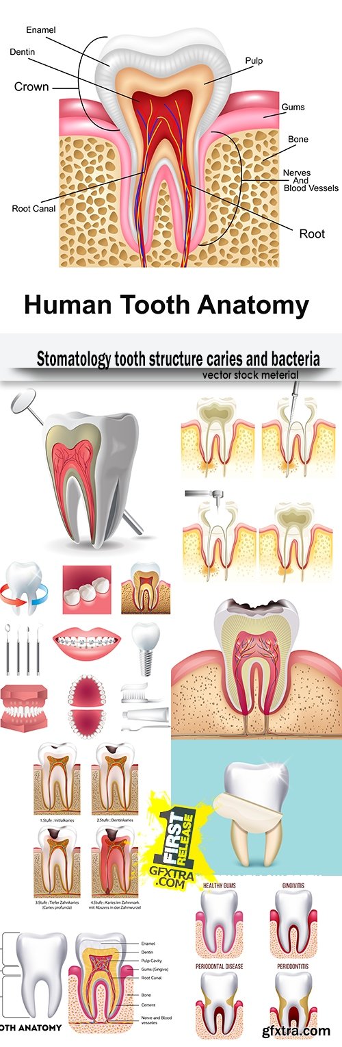 Stomatology tooth structure caries and bacteria