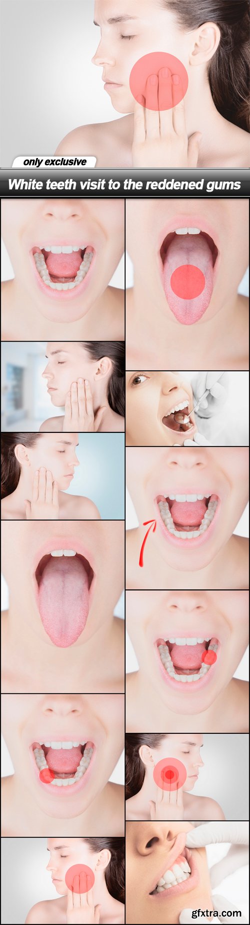 White teeth visit to the reddened gums - 12 UHQ JPEG