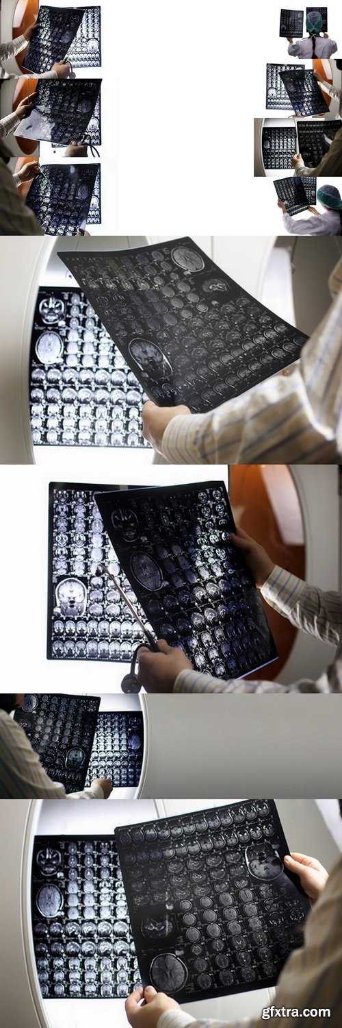 Doctor holding a picture of a brain MRI workflow