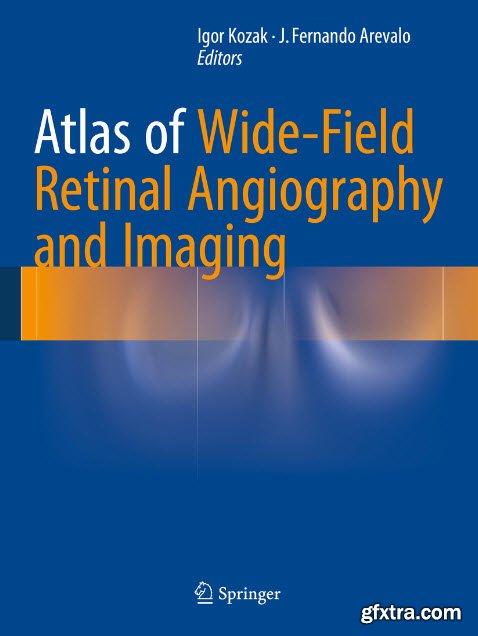 Atlas of Wide-Field Retinal Angiography and Imaging (EPUB)