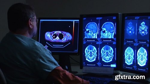 Radiologist watching monitors of brain scan
