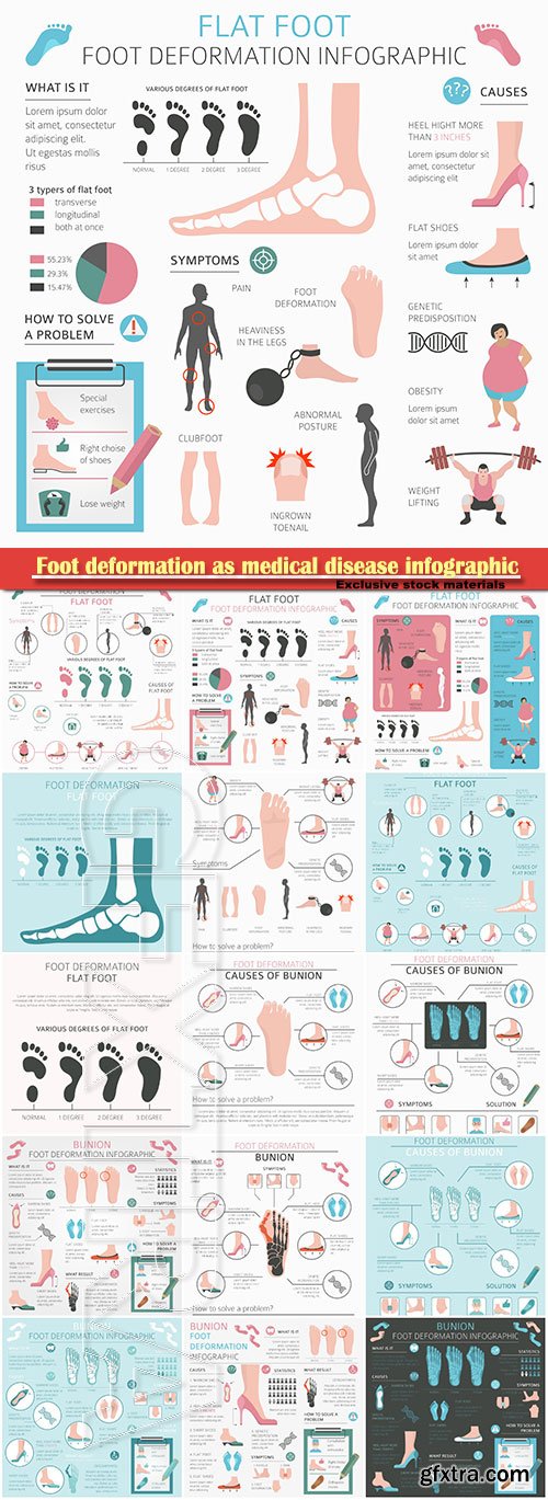 Foot deformation as medical disease infographic