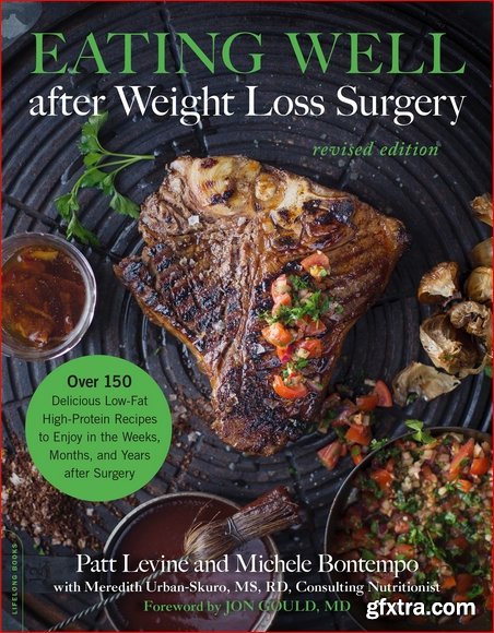 Eating Well after Weight Loss Surgery