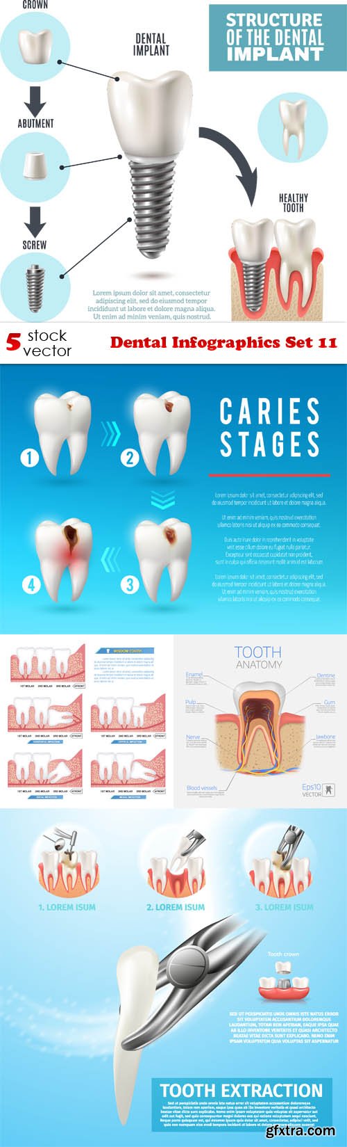 Vectors - Dental Infographics Set 11