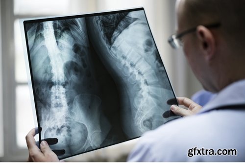 Doctor With Patient\'s X-Ray Film Mockup