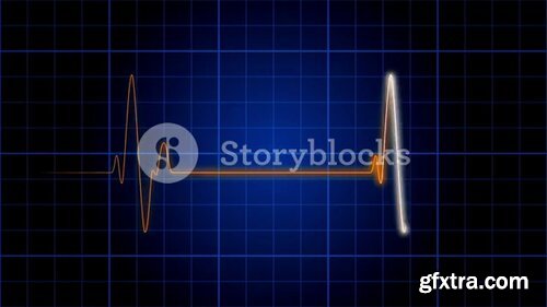 Videoblocks - EKG 004: An electrocardiogram heart monitor pulses on a blue grid | Animated Backgrounds
