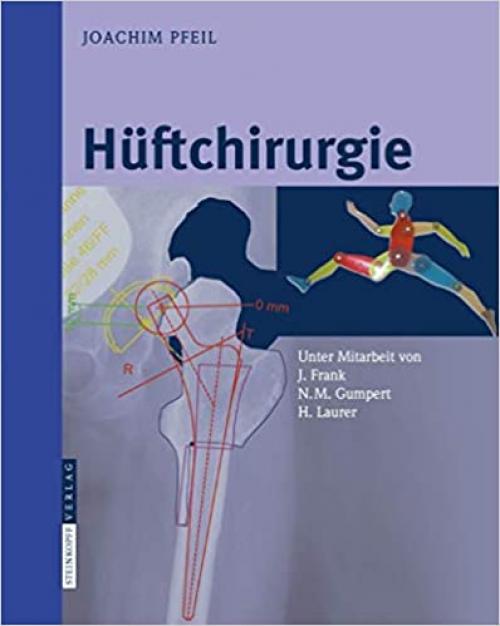 Hüftchirurgie (German Edition)