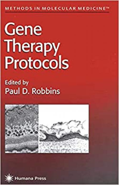 Gene Therapy Protocols (Methods in Molecular Medicine)