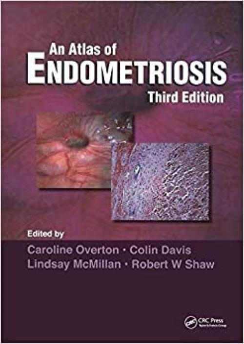 Atlas of Endometriosis (Encyclopedia of Visual Medicine Series)