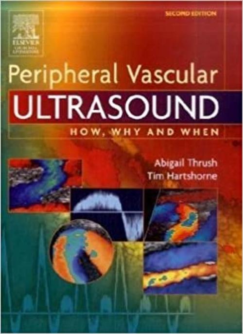 Peripheral Vascular Ultrasound: How, Why and When