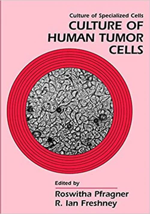 Culture of Human Tumor Cells