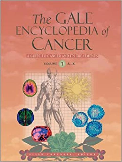 The Gale Encyclopedia of Cancer (Two Volume Set)