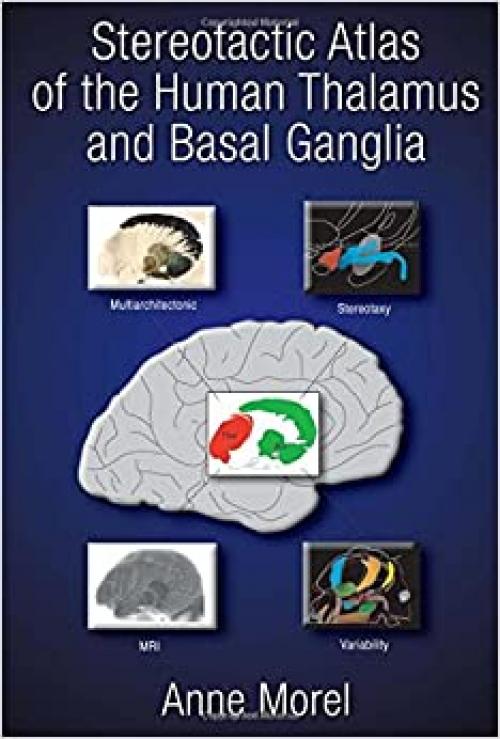 Stereotactic Atlas of the Human Thalamus and Basal Ganglia