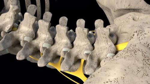 Videohive - Spinal Nerve Inflammation - 32394785
