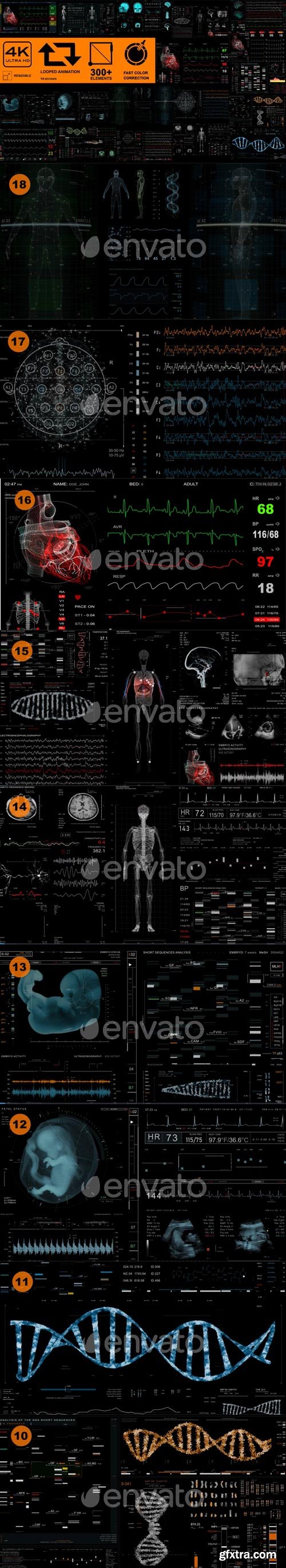 Videohive - Medical Pack 18 Screens (300+ elements) - 31030245