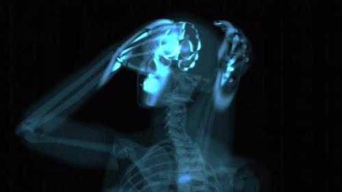 Videohive - 4K abstract Xray anatomy concept of a headache - 32933868