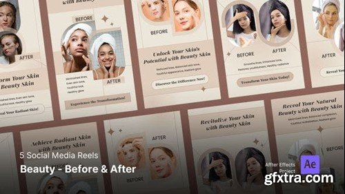 Videohive Social Media Reels - Beauty Before and After 45981770